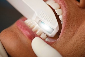 顔のシミュレーション